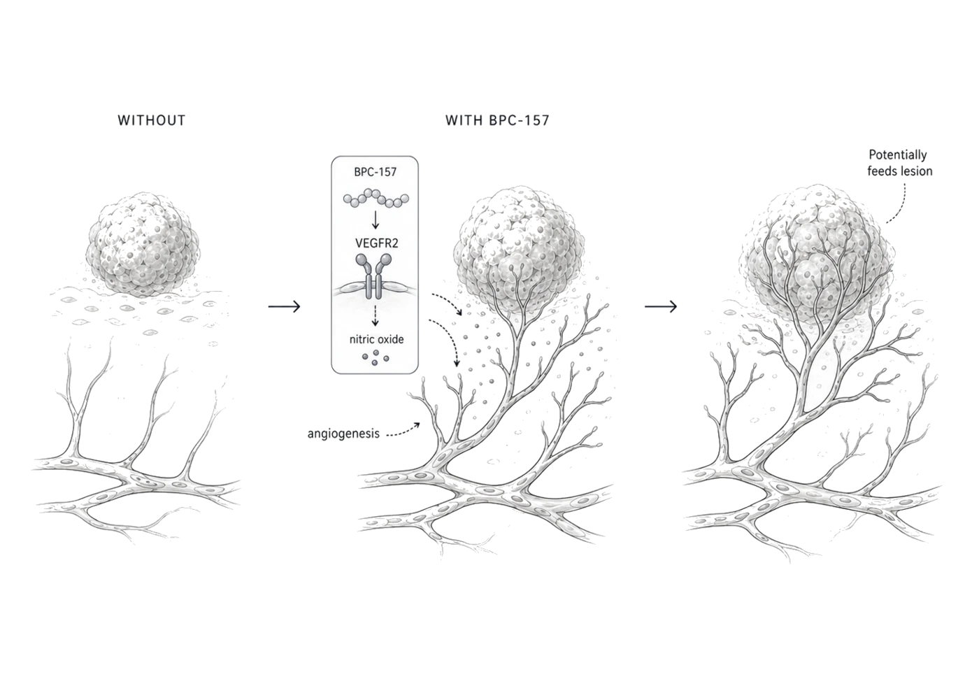 Three-panel sketch. Without BPC-157: a lesion sits over a sparse bed of blood vessels. With BPC-157: the peptide activates VEGFR2 and nitric oxide to drive angiogenesis, and new vessels sprout toward the lesion. Outcome: a denser vascular network that potentially feeds the lesion.